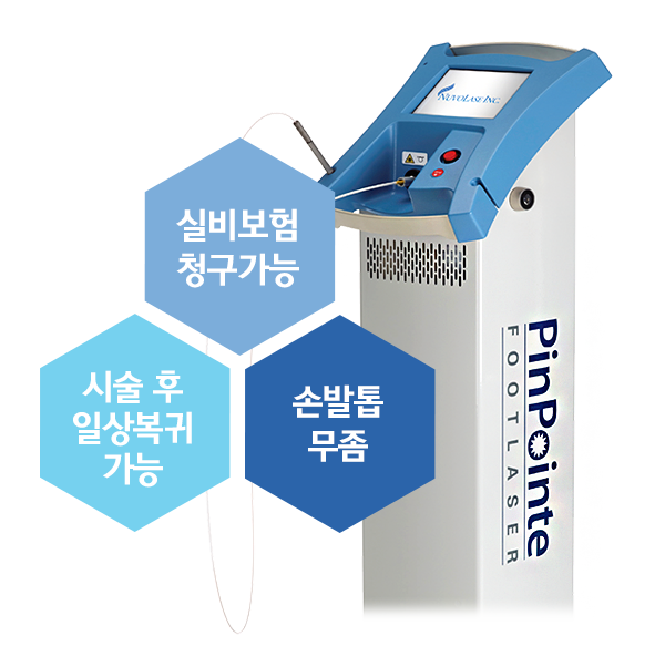 핀포인트 레이저