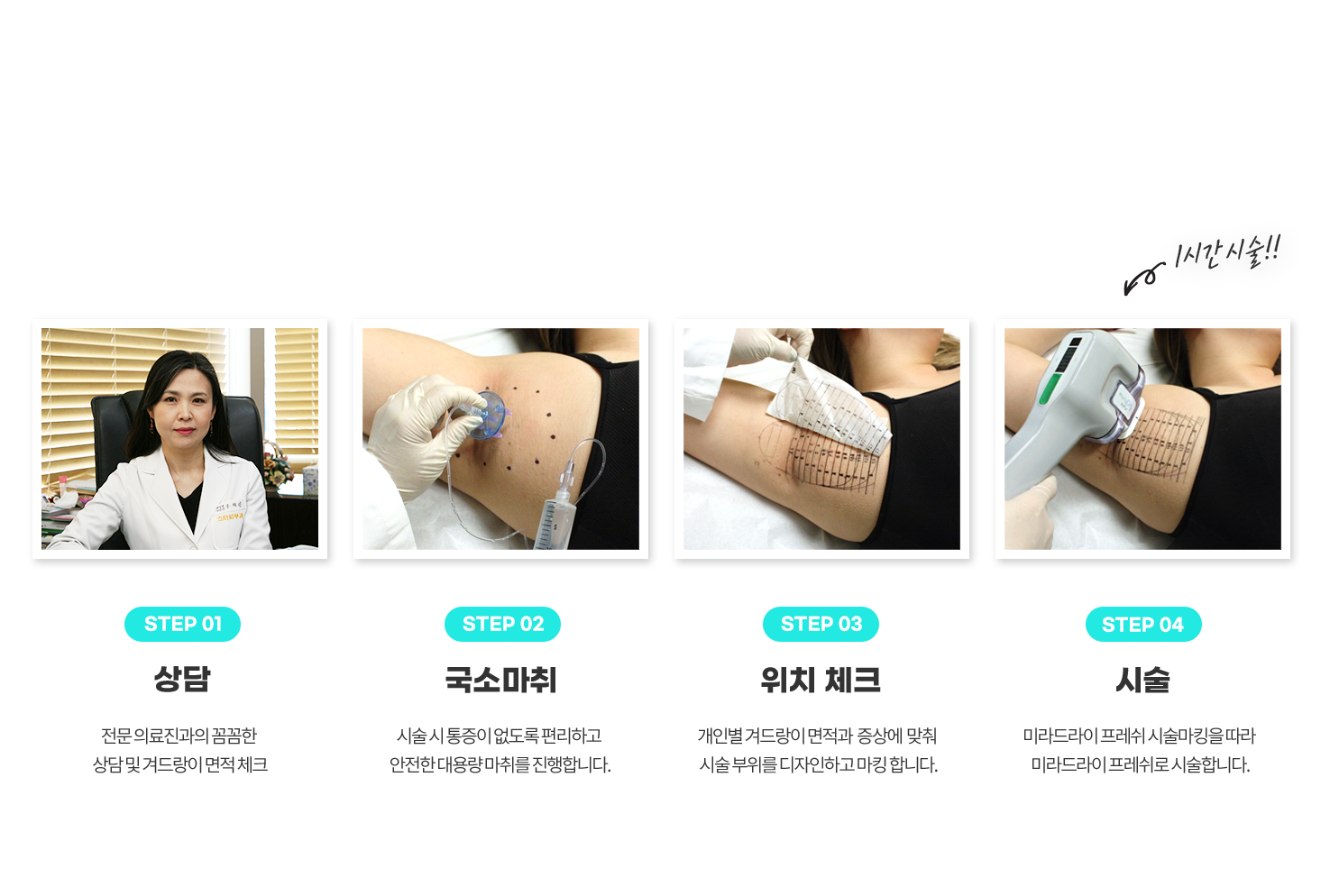 스타피부과 다한증 미라드라이 프레쉬